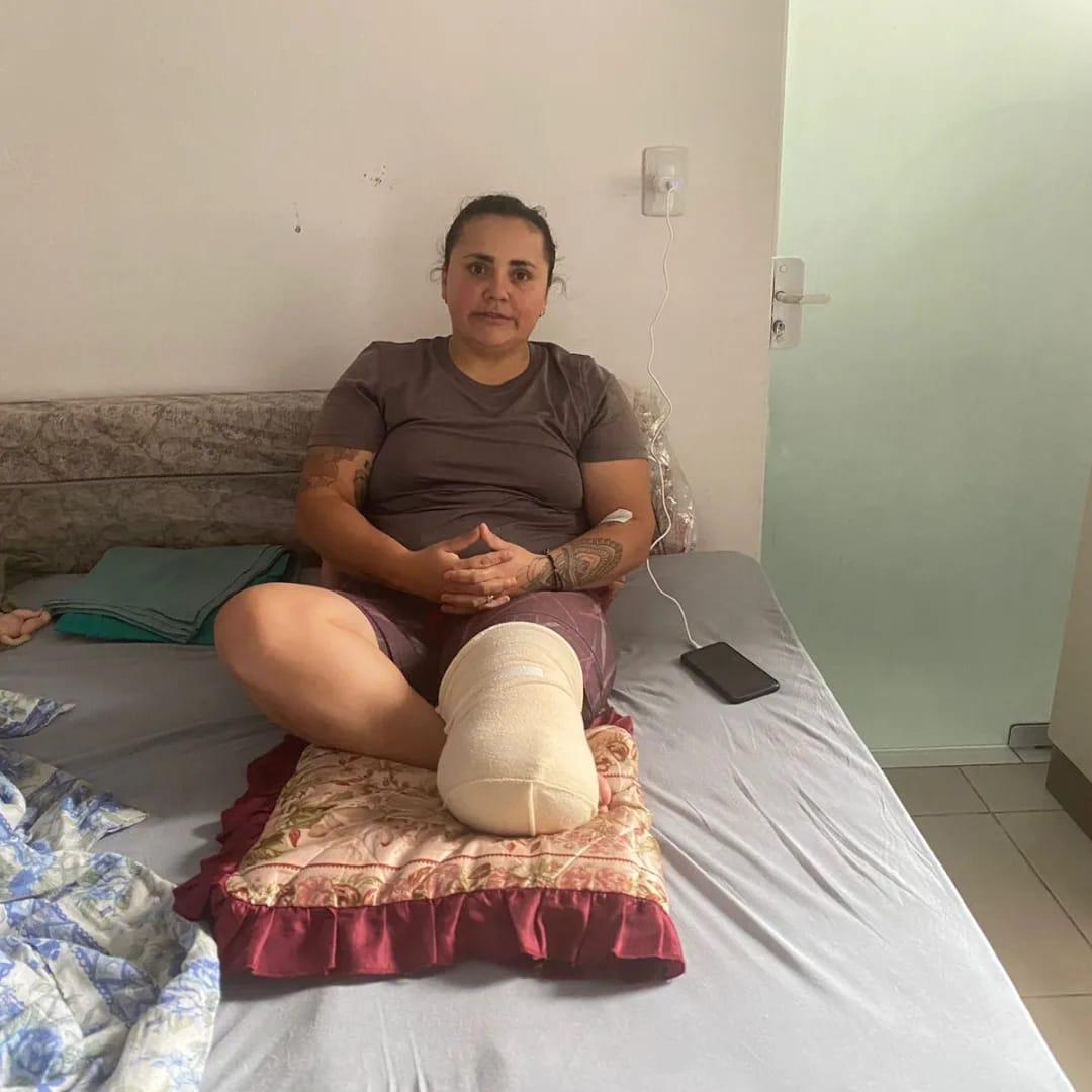 Damaris busca ajuda para aquisição de prótese para voltar a trabalhar