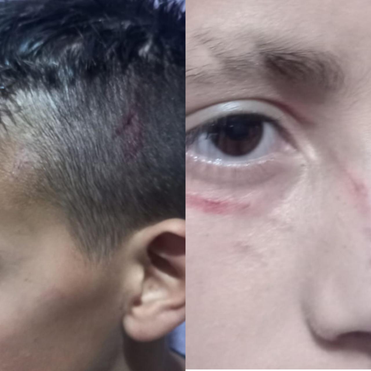 Agressão dentro de escola em Candiota resulta em boletim de ocorrência