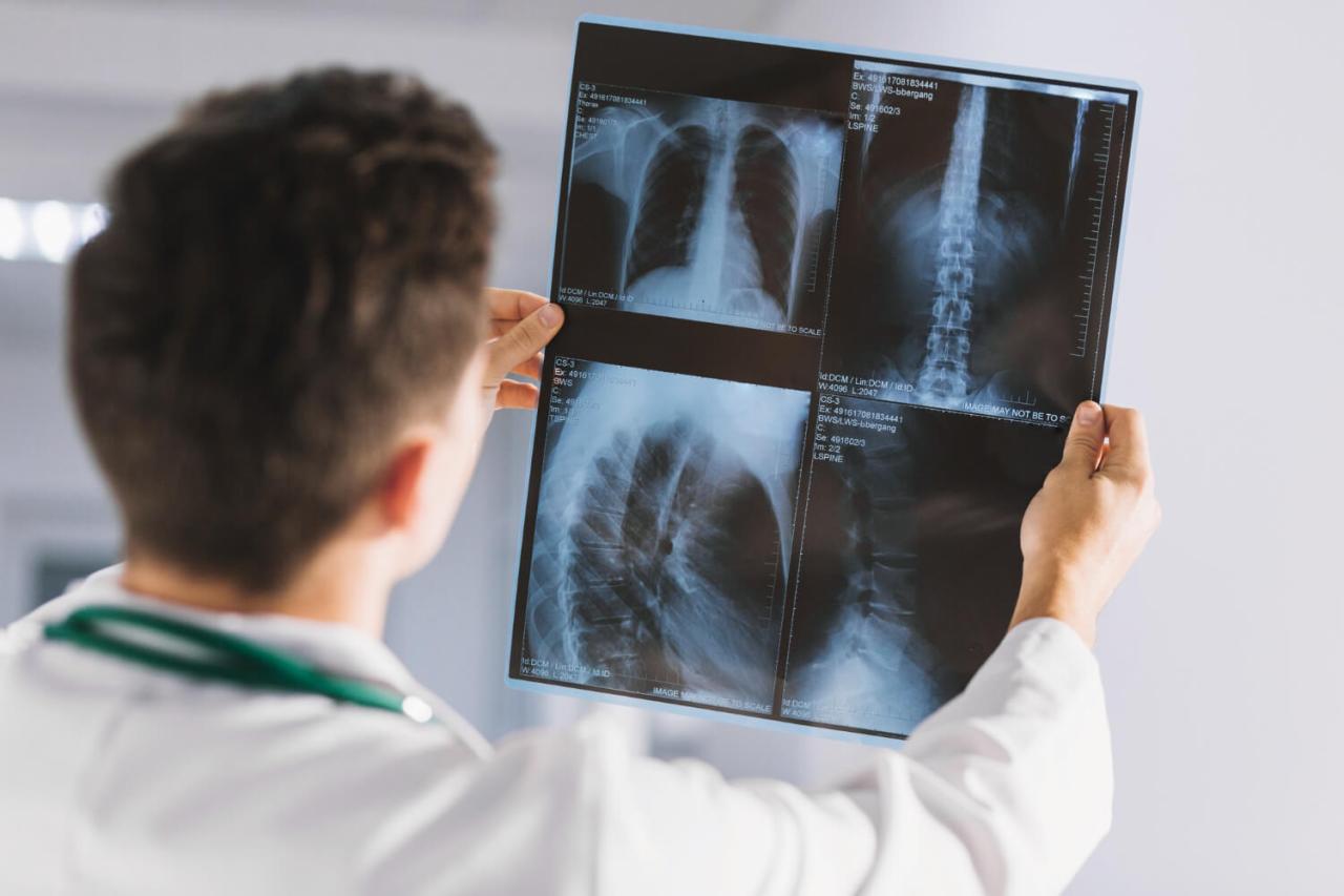 Projeto busca a regulamentação da profissão de técnico de radiologia